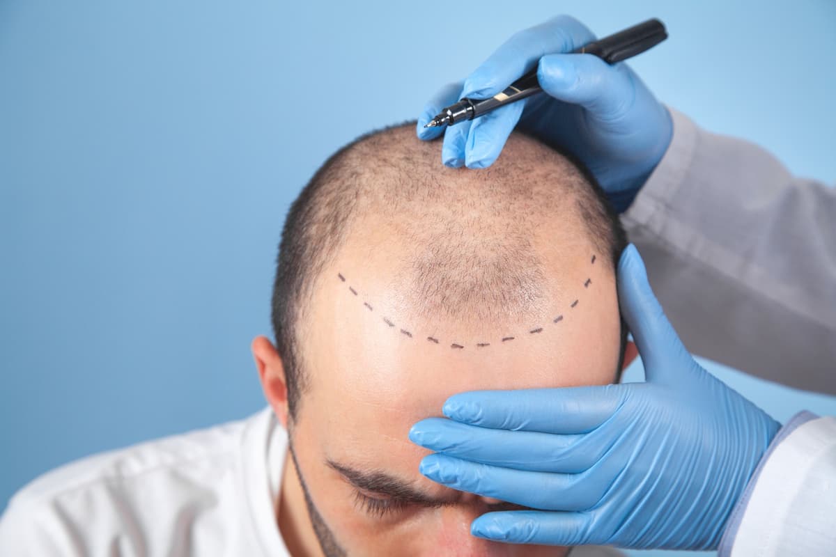 PRP Therapy